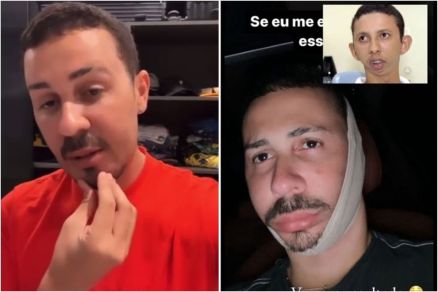 Carlinhos Maia faz piada sobre procedimento estético e usa foto de morador de MT com má formação