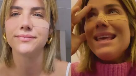 Giovanna Ewbank compartilha detalhes de cirurgia no nariz