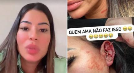 Milena Lins denuncia suposta agressão do ex-namorado: 'Ele está me destruindo'