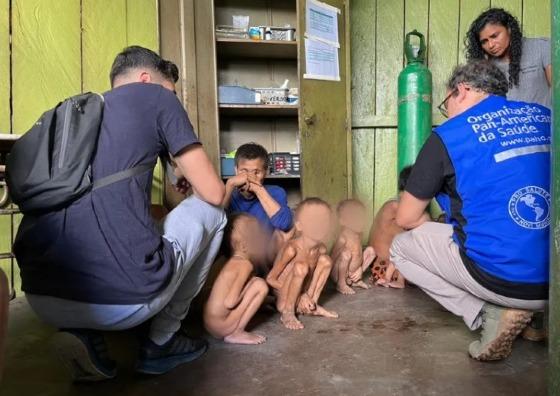 Sociedade Brasileira de Medicina abre chamada de apoio aos Yanomami