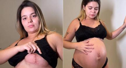 Viih Tube mostra marcas no corpo geradas pela gravidez